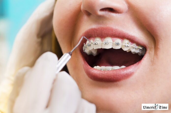 How Orthodontic Treatment Can Prevent Oral Health Issues